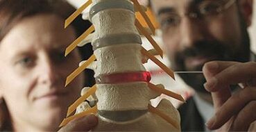 студија за остеохондроза на модел на 'рбетот