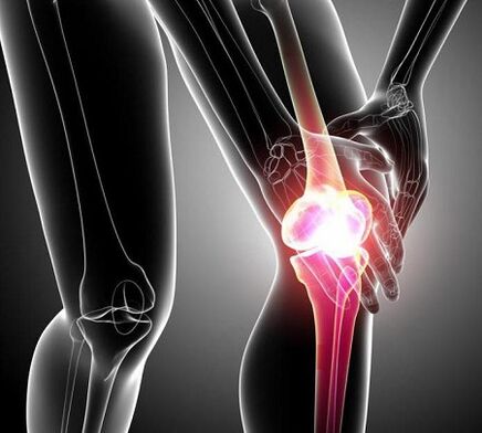 оштетување на коленото зглоб со артритис и артроза