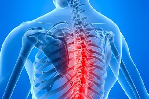 'рбетниот лезија во случај на торакална остеохондроза