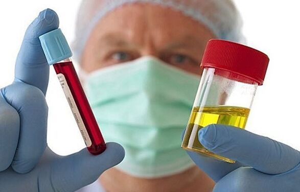 Начини за дијагностицирање на остеохондроза на цервикалниот 'рбет